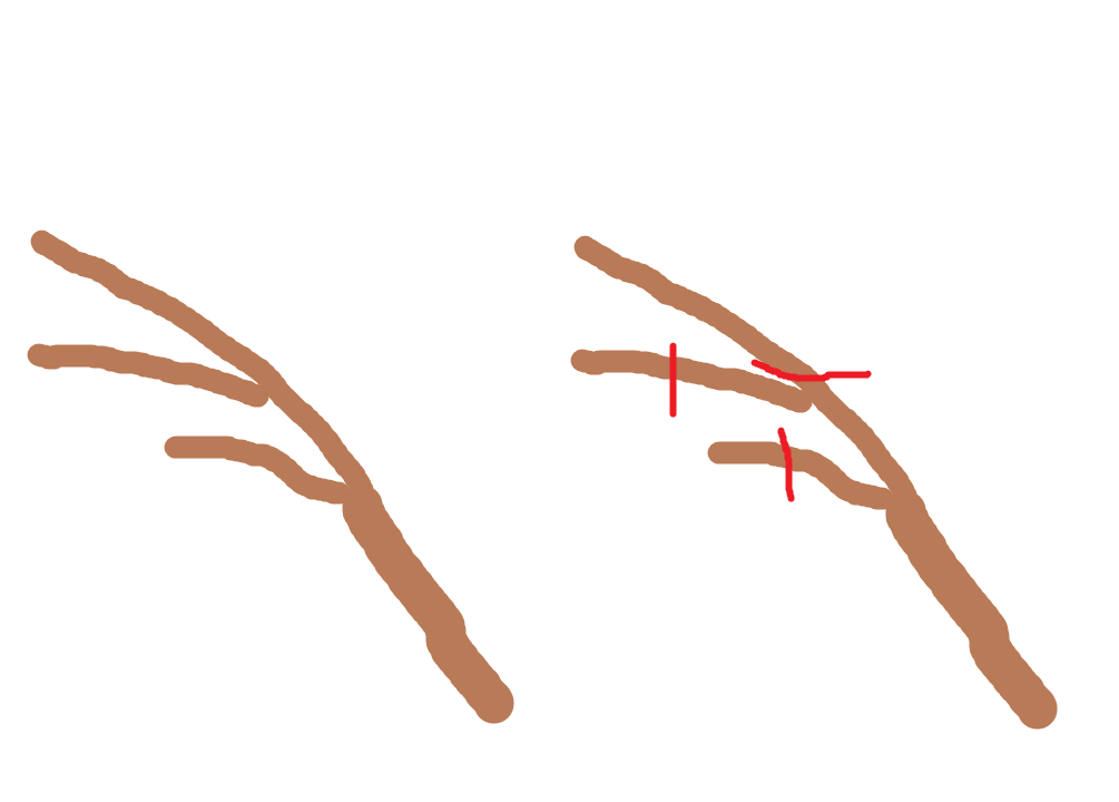 A talented artist's depiction of Diopyrus kaki pruning ^